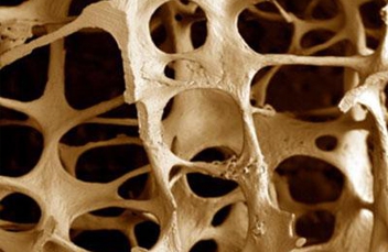 Причины и развитие остеопороза